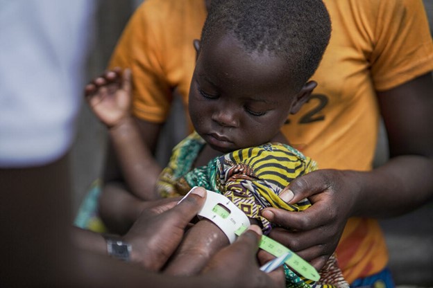 A child is checked for malnutrition at Kanyaruchinya health centre, in DRC's conflict-hit Nord Kivu province. Pope Francis is expected to address conflict and hunger during his visit to the country DRC and South Sudan crises